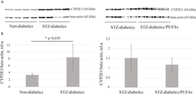 Treatment with omega-3 PUFAs does not increase the risk of <mark class="highlighted">CYP2E1</mark>-dependent oxidative stress and diabetic liver pathology